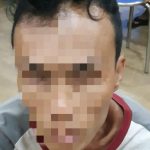 Akibat Mencuri Speedometer Mobil, Pria Berinisial "F" Diamankan Polisi