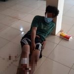 Di "dor" Polisi, Pelaku Begal Bersajam Ini Keok