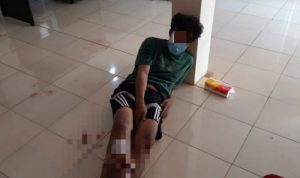 Di "dor" Polisi, Pelaku Begal Bersajam Ini Keok