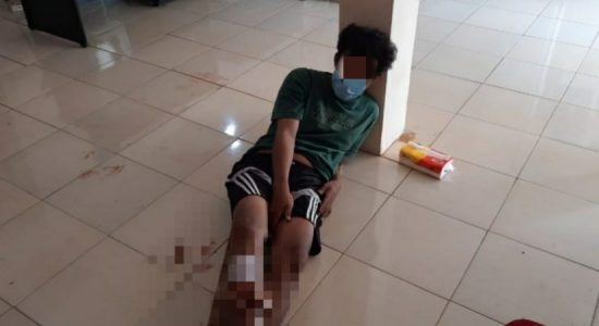 Di "dor" Polisi, Pelaku Begal Bersajam Ini Keok