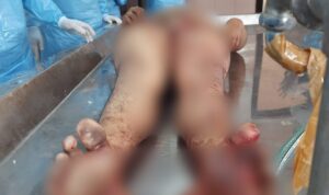 Warga IT II Palembang Meregang Nyawa Usai Alat Vital Ditusuk Lawan Duel